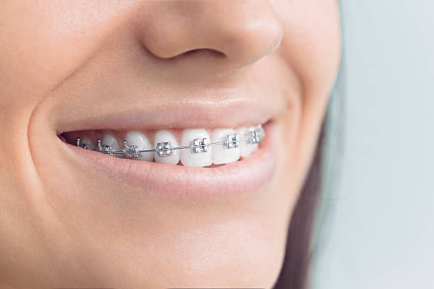 Best Invisalign and Clear Aligners  in Stanfield, NC